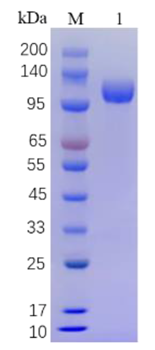 Recombinant Human sFLT-1 Protein, C-His