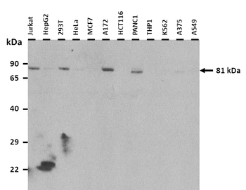 ZBTB20 Rabbit Polyclonal Antibody