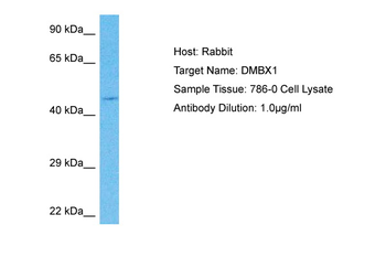 DMBX1 Rabbit Polyclonal Antibody