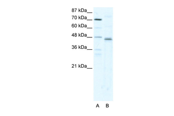 ZFP1 Rabbit Polyclonal Antibody