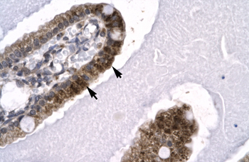 SKIIP Rabbit Polyclonal Antibody