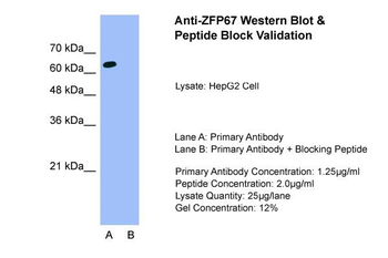 ZFP67 Rabbit Polyclonal Antibody