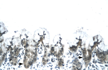 ACDC Rabbit Polyclonal Antibody