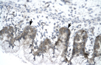 IVNS1ABP Rabbit Polyclonal Antibody