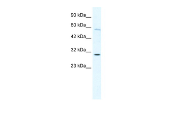 GATAD1 Rabbit Polyclonal Antibody