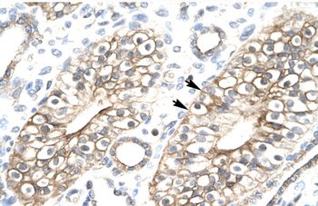 FLJ11730 Rabbit Polyclonal Antibody