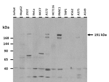 KIF1A Rabbit Polyclonal Antibody