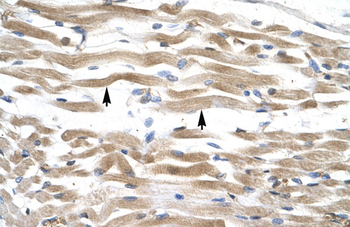 KIFC2 Rabbit Polyclonal Antibody