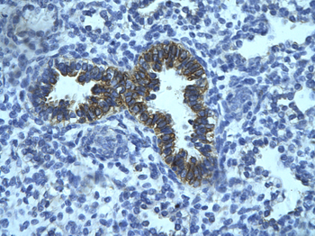 JADE3 Rabbit Polyclonal Antibody