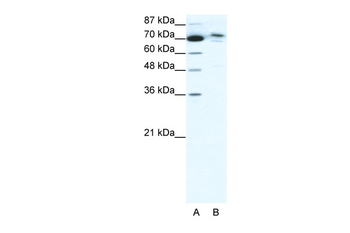 C14ORF101 Rabbit Polyclonal Antibody