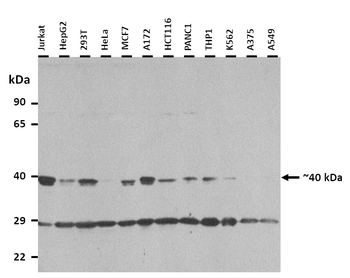 TFB1M Rabbit Polyclonal Antibody