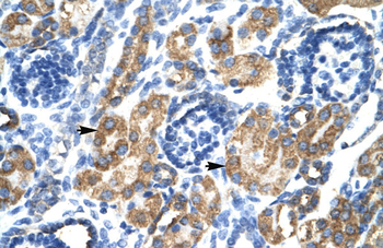 HSF2BP Rabbit Polyclonal Antibody