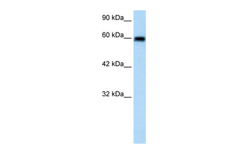 VMD2L2 Rabbit Polyclonal Antibody