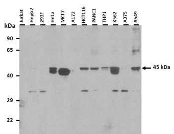 KCNJ1 Rabbit Polyclonal Antibody