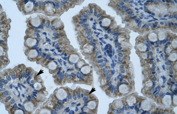 GIOT-1 Rabbit Polyclonal Antibody