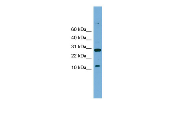 Tal2 Rabbit Polyclonal Antibody