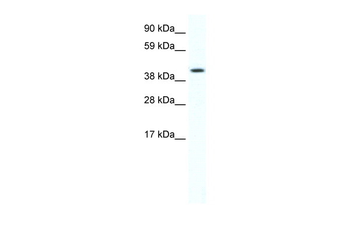 FOXF1A Rabbit Polyclonal Antibody