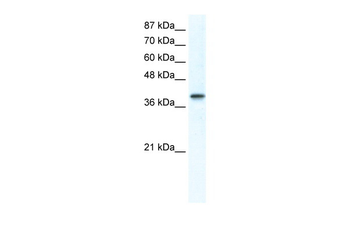 TCFAP4 Rabbit Polyclonal Antibody