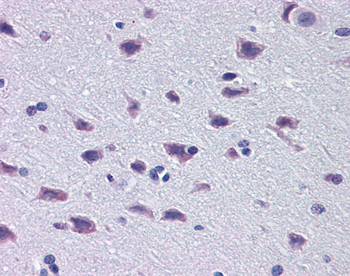 DMBX1 Rabbit Polyclonal Antibody