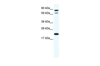 ZFP287 Rabbit Polyclonal Antibody