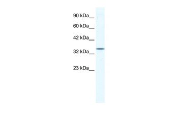 ZFP589 Rabbit Polyclonal Antibody