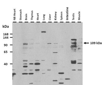 Ighmbp2 Rabbit Polyclonal Antibody
