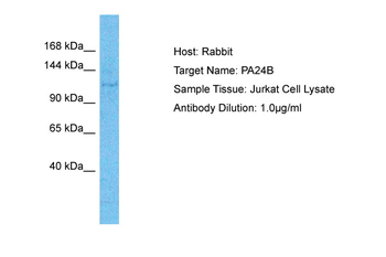 PLA2G4B Rabbit Polyclonal Antibody