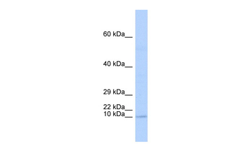 TAL2 Rabbit Polyclonal Antibody