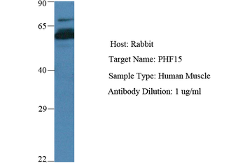 JADE2 Rabbit Polyclonal Antibody