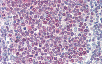 TGFB1I1 Rabbit Polyclonal Antibody