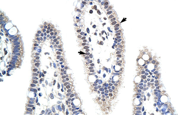 MDS032 Rabbit Polyclonal Antibody