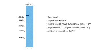 UTX Rabbit Polyclonal Antibody