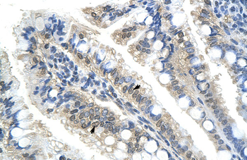 BTBD14B Rabbit Polyclonal Antibody