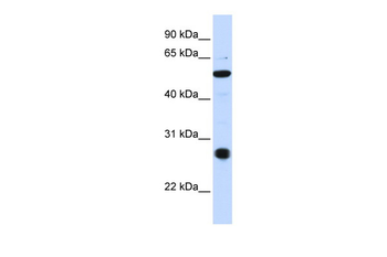 ZUP1 Rabbit Polyclonal Antibody