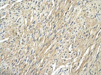 RPS29 Rabbit Polyclonal Antibody