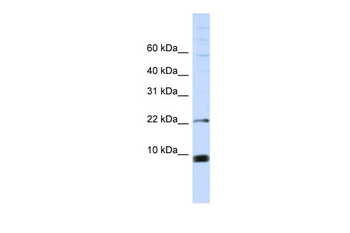 SNRPF Rabbit Polyclonal Antibody