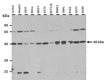 SFRS6 Rabbit Polyclonal Antibody