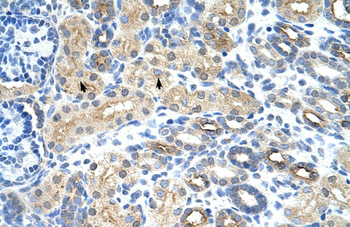 U1SNRNPBP Rabbit Polyclonal Antibody