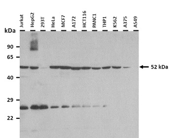 BRUNOL5 Rabbit Polyclonal Antibody