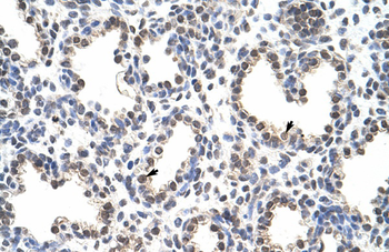 FLJ12529 Rabbit Polyclonal Antibody
