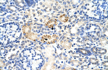 RBM4B Rabbit Polyclonal Antibody