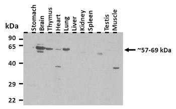 SLC6A2 Rabbit Polyclonal Antibody