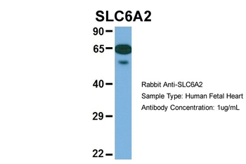 SLC6A2 Rabbit Polyclonal Antibody