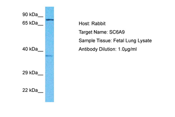 SLC6A9 Rabbit Polyclonal Antibody