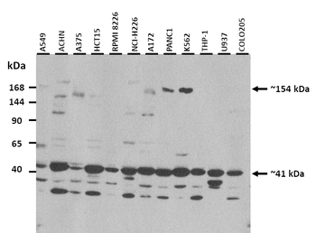 CEMIP2 Rabbit Polyclonal Antibody