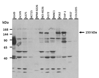 CEMIP Rabbit Polyclonal Antibody