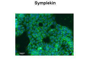 SYMPK Rabbit Polyclonal Antibody