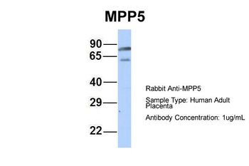 MPP5 Rabbit Polyclonal Antibody
