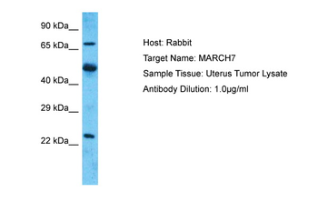 MARCH7 Rabbit Polyclonal Antibody