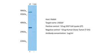 C6orf21 Rabbit Polyclonal Antibody